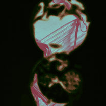 Roxy album cover